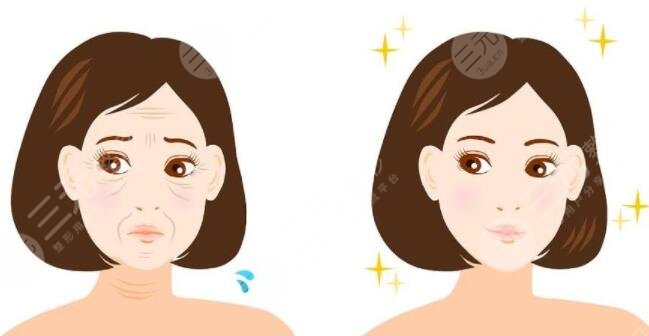 面部提拉緊致手術(shù)護理注意事項