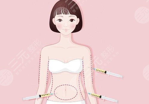 吸脂手術(shù)對(duì)身體有哪些危害?