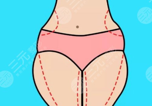 吸脂手術(shù)對(duì)身體有哪些危害?