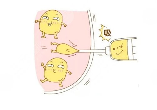 吸脂手術(shù)對(duì)身體有哪些危害?