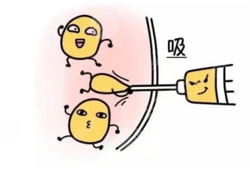 腰腹部抽脂對身體有什么傷害？