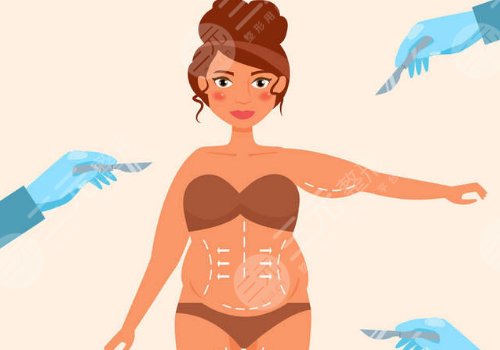 腰腹部抽脂對身體有什么傷害