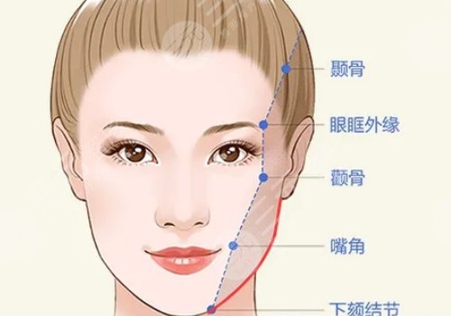 面部折疊度高好看嗎