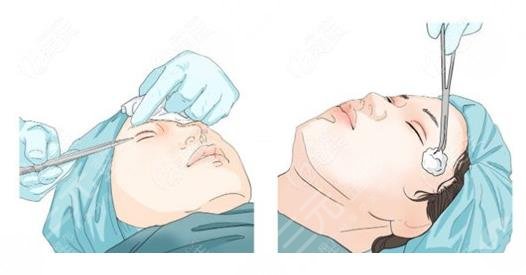 面部折疊度高好看嗎