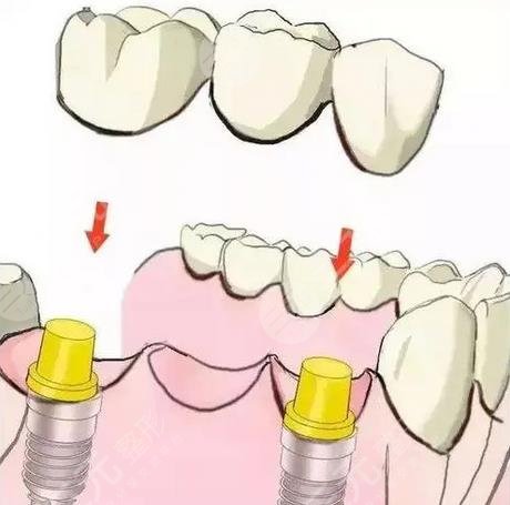 上海仁濟醫(yī)院口腔科擅長科普知識