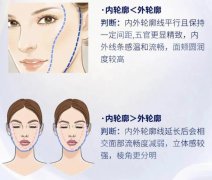 雙矢量提升效果好嗎？拉皮除皺新選擇，手術(shù)原理科普！