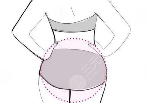 人魚體雕可以維持多久？