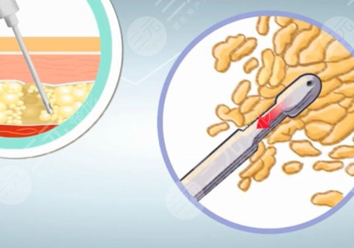 浙江大學(xué)醫(yī)學(xué)院附屬第一醫(yī)院整形外科技術(shù)怎么樣？