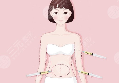 人魚體雕和普通吸脂區(qū)別