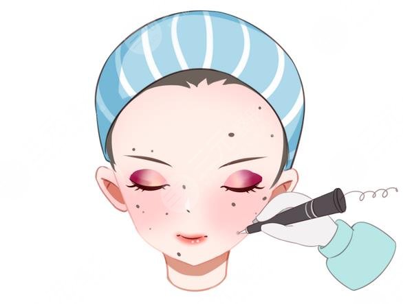 上海華山醫(yī)院祛斑案例