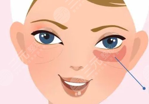 思伊美玻尿酸是國(guó)產(chǎn)的嗎