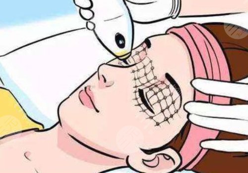 以色列飛頓熱拉提plus作用原理是什么？