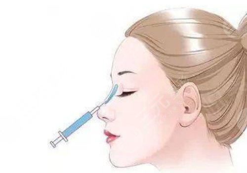 廣州顏玲做鼻子如何？
