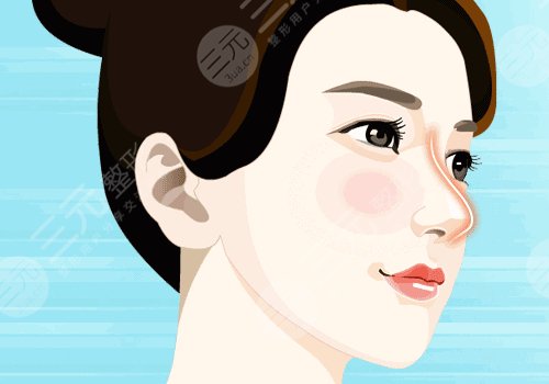 徐翔醫(yī)生做鼻子怎么樣 