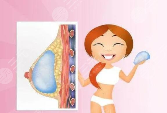 德美假體可以終身不取嗎？放在身體一輩子會怎么樣？乳腺專家回答