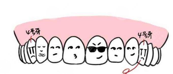 牙齒矯正