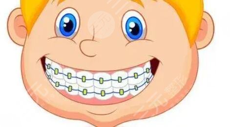 牙齒矯正