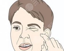 面癱后遺癥大小眼能整形嗎？手術(shù)科普，價(jià)格參考！