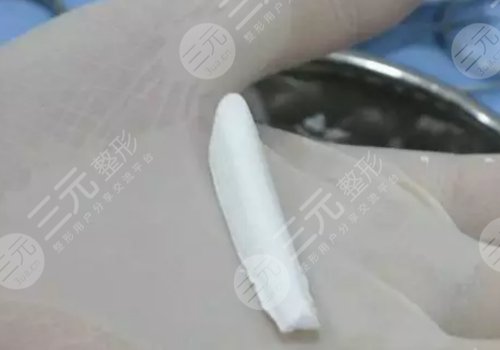 美植挺膨體是國產(chǎn)還是進(jìn)口