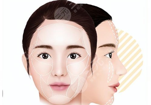 饅化針是什么產(chǎn)品