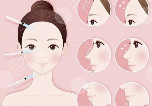 饅化針是什么成分？