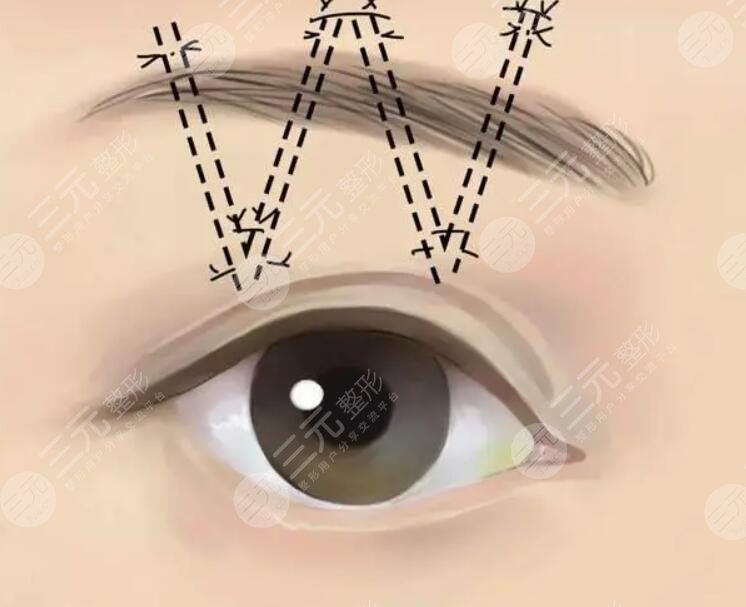 王召東醫(yī)生擅長項目介紹