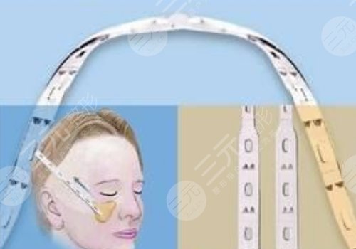 微拉美是什么整容項目