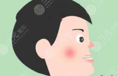 牙齒地包天怎么緩解矯正？正畸原理、價(jià)格表分享！