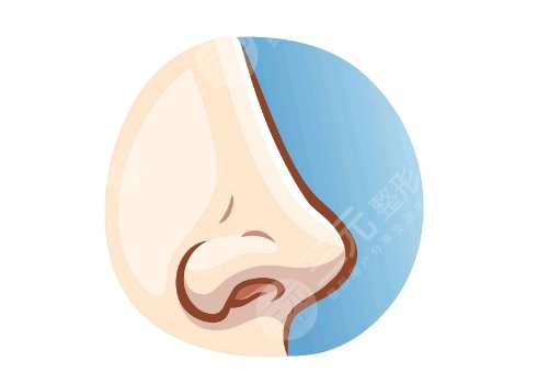 做鼻子二十多萬是不是被坑了