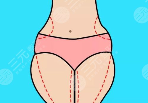 全身抽脂50斤的價(jià)格