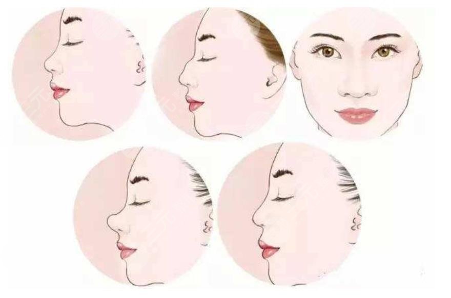 上海長(zhǎng)海醫(yī)院整形外科隆鼻案例