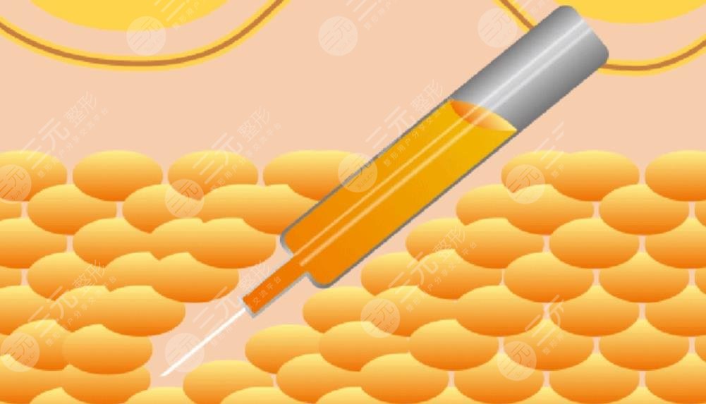 北京空軍總醫(yī)院美容整形中心吸脂案例