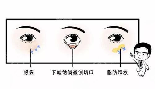 南京去眼袋整形術(shù)的費用價格查詢！3家靠譜醫(yī)院可選~
