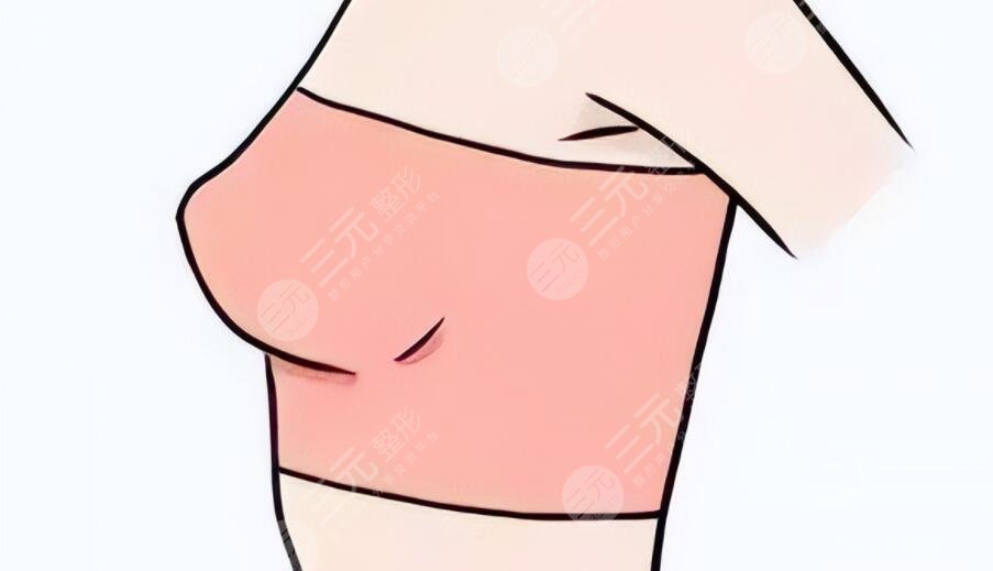 做了假體隆胸會不會癌變？乳腺專家跟蹤調(diào)查后總結(jié)~