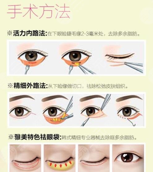 上海九院整復(fù)外科開展項(xiàng)目科普