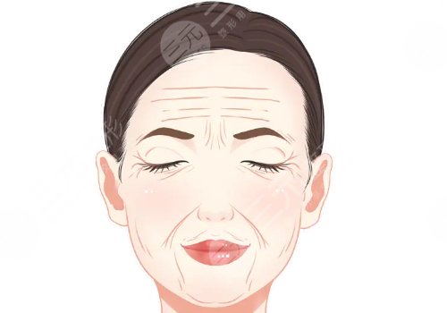 筋膜提升術(shù)多少錢？