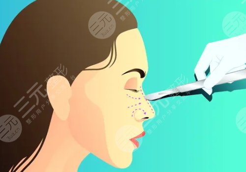 水滴鼻和鷹鉤鼻圖片