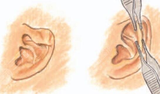 海藝星醫(yī)療美容醫(yī)院擅長項目介紹