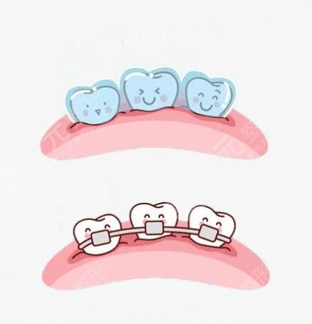 武漢同濟(jì)醫(yī)院牙齒矯正怎么樣