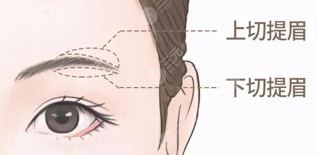 提眉
