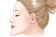 骨性地包天能矯正過(guò)來(lái)嗎？正頜手術(shù)，幫你重塑臉型！