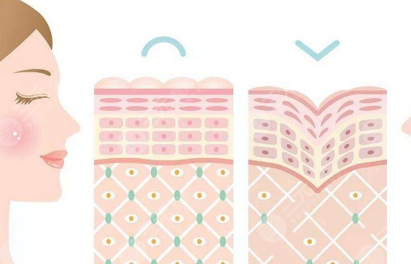 40歲抗衰老醫(yī)美項(xiàng)目有哪些？