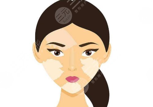 用什么土方治白斑？