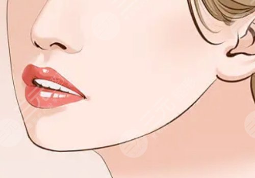 下顎整容手術(shù)一般要多少錢