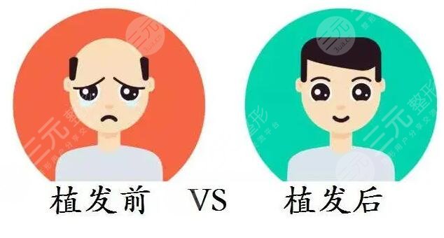 上海仁濟(jì)醫(yī)院植發(fā)中心發(fā)際線改良案例