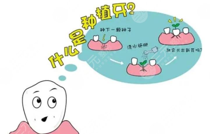 上海種植一顆牙齒大概多少錢