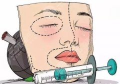 芙妮薇玻尿酸是哪國的？多少錢一支？維持多久？