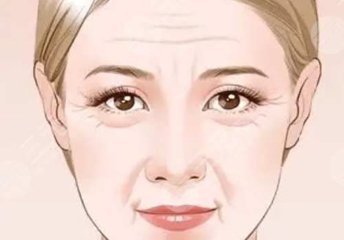 筋膜懸吊面部提升術(shù)價(jià)格