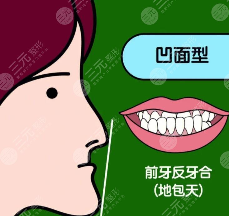 成人地包天手術(shù)整形費(fèi)用多少錢(qián)？2023年市場(chǎng)均價(jià)1-3萬(wàn)不等~