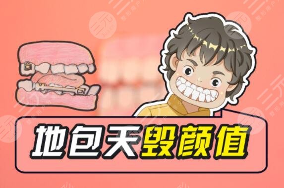 成人地包天手術(shù)整形的方式有哪些?